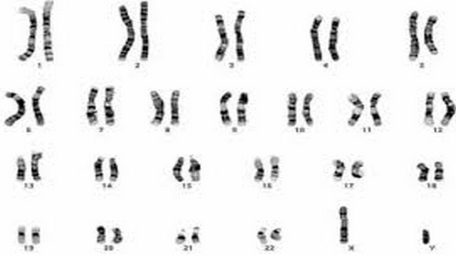 Image des chromosomes